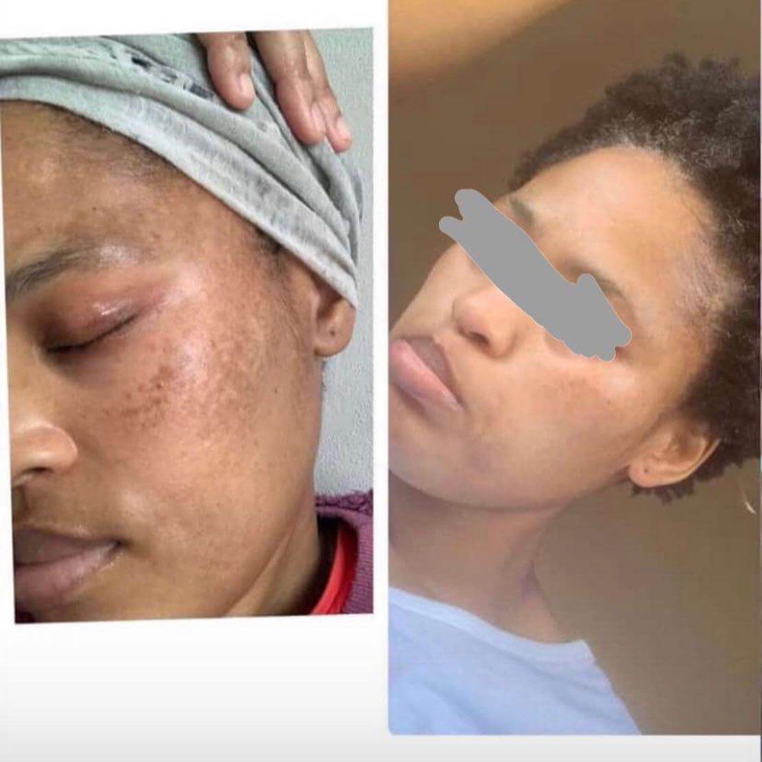 African butteress Skin Care